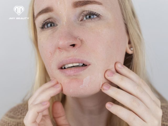 Peel da sinh học an toàn cho da nhạy cảm